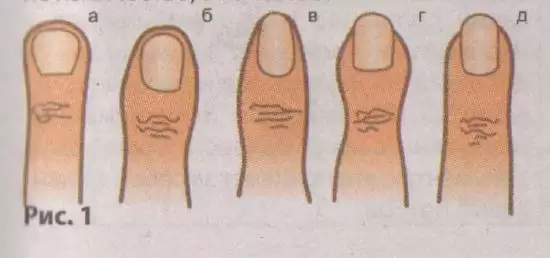 Форма пальців
